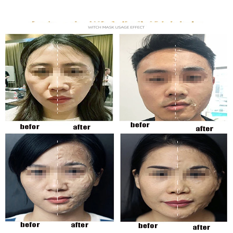 Mais recentes coreano cosmeticsPeptide 5 Segundos Rugas Remova a Máscara Firmadora Eterno Aperte Hidratante, Escova de Rosto Célula de Cuidados com a Pele Imagem 3
