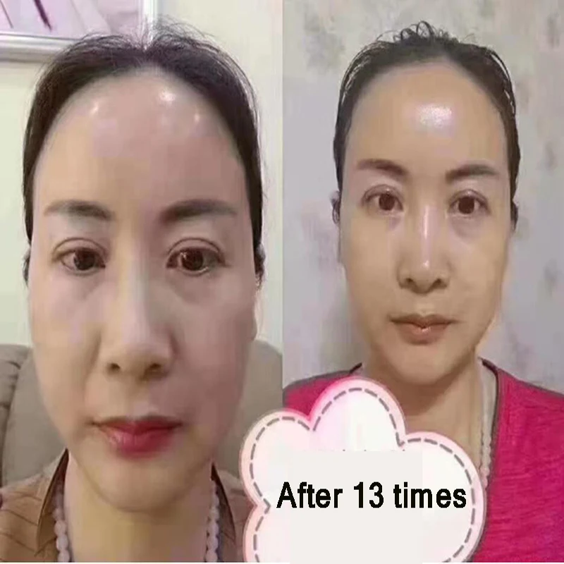 Mais recentes coreano cosmeticsPeptide 5 Segundos Rugas Remova a Máscara Firmadora Eterno Aperte Hidratante, Escova de Rosto Célula de Cuidados com a Pele Imagem 4