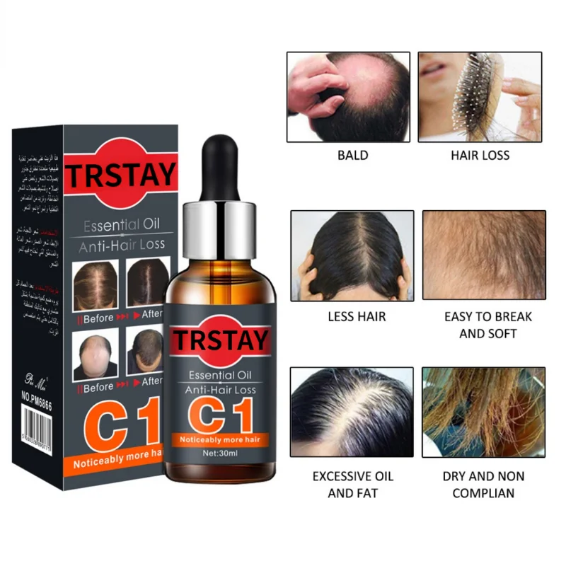 Spray de cabelo PRODUTOR de Produtos Anti-queda de cabelo o Óleo Essencial de Crescimento de Soro de Crescimento do Cabelo para Homens Imagem 2