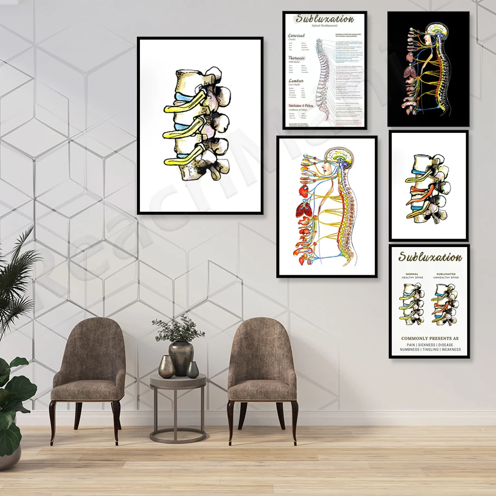 Subluxação vertebral cartaz, sistema nervoso autônomo, cartaz, coluna vertebral ANS diagrama, quiropraxia office cartaz, tensão de nervo, chiropr Imagem 1