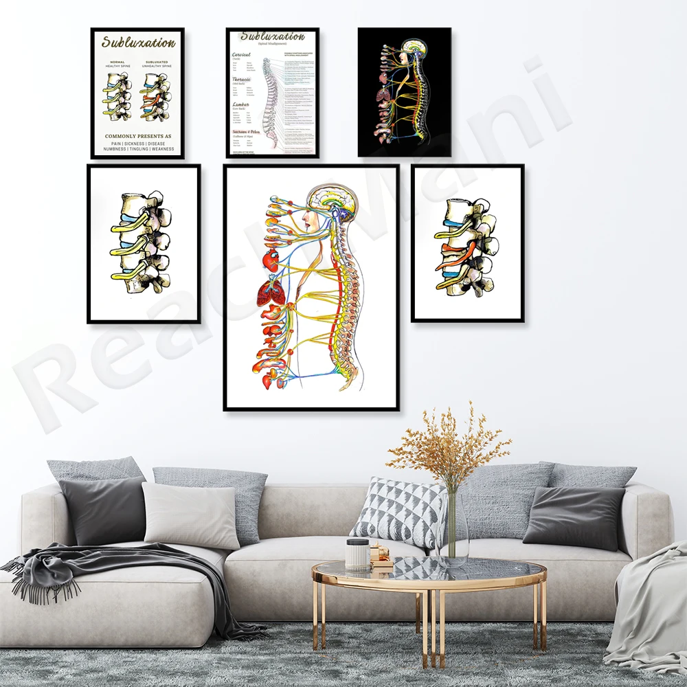 Subluxação vertebral cartaz, sistema nervoso autônomo, cartaz, coluna vertebral ANS diagrama, quiropraxia office cartaz, tensão de nervo, chiropr Imagem 3