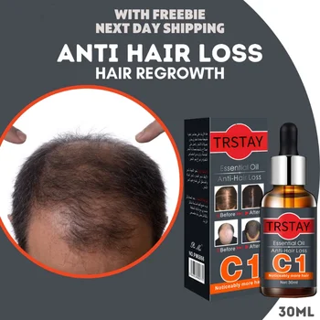 Spray de cabelo PRODUTOR de Produtos Anti-queda de cabelo o Óleo Essencial de Crescimento de Soro de Crescimento do Cabelo para Homens